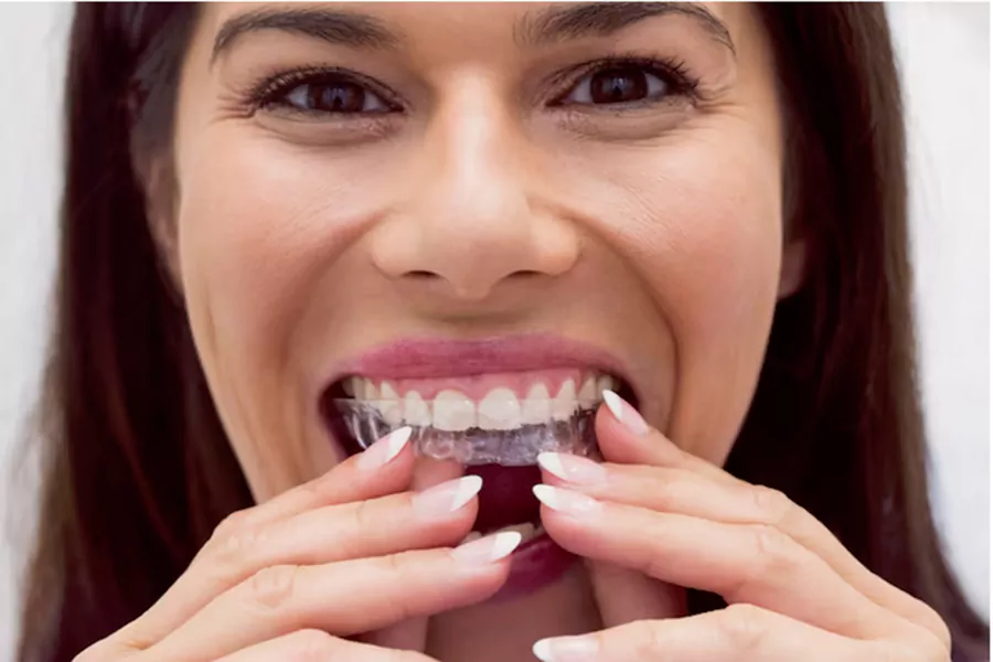 ریتینر یا پلاک نگهدارنده