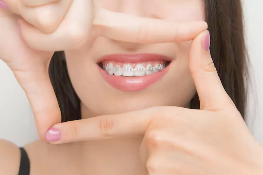 استفاده از ریتینر