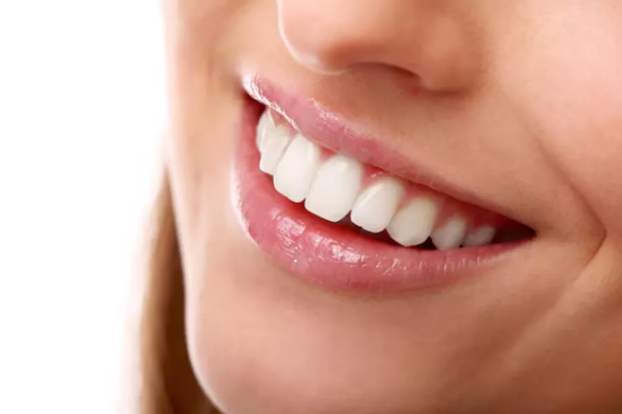 تفاوت میان لمینت و کامپوزیت