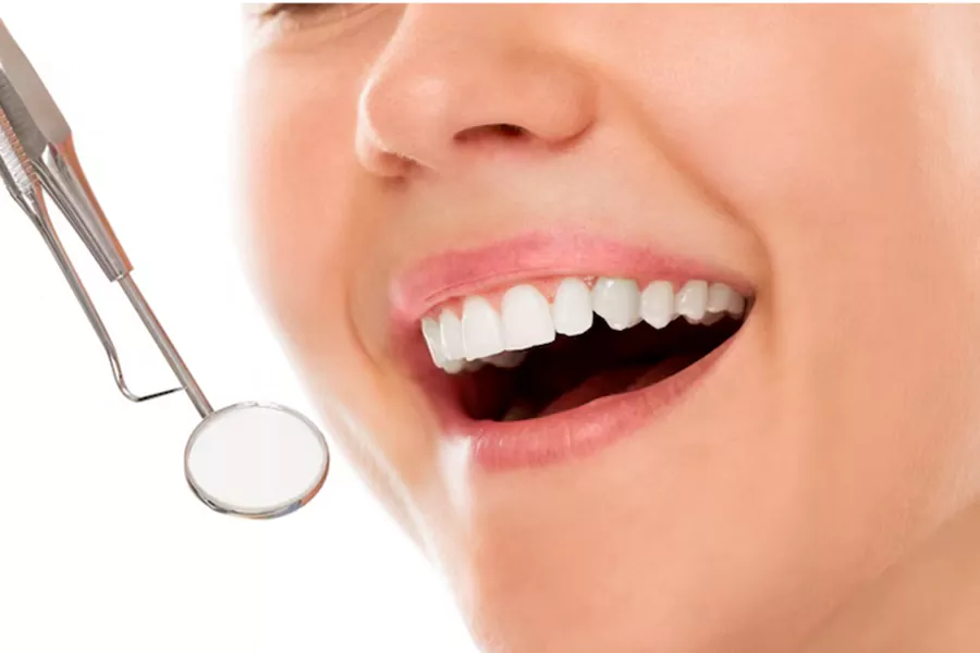 طول عمر کامپوزیت دندان