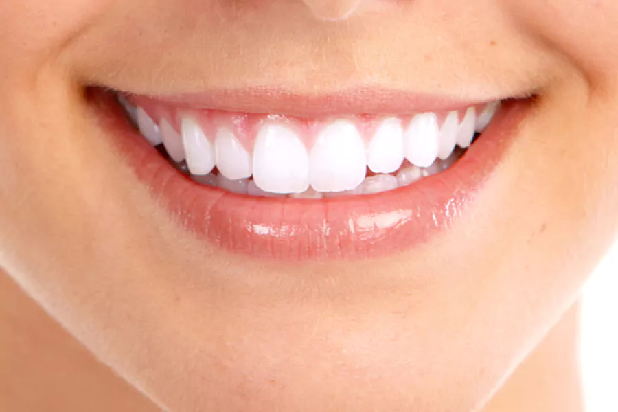 لمینت خرگوشی دندان