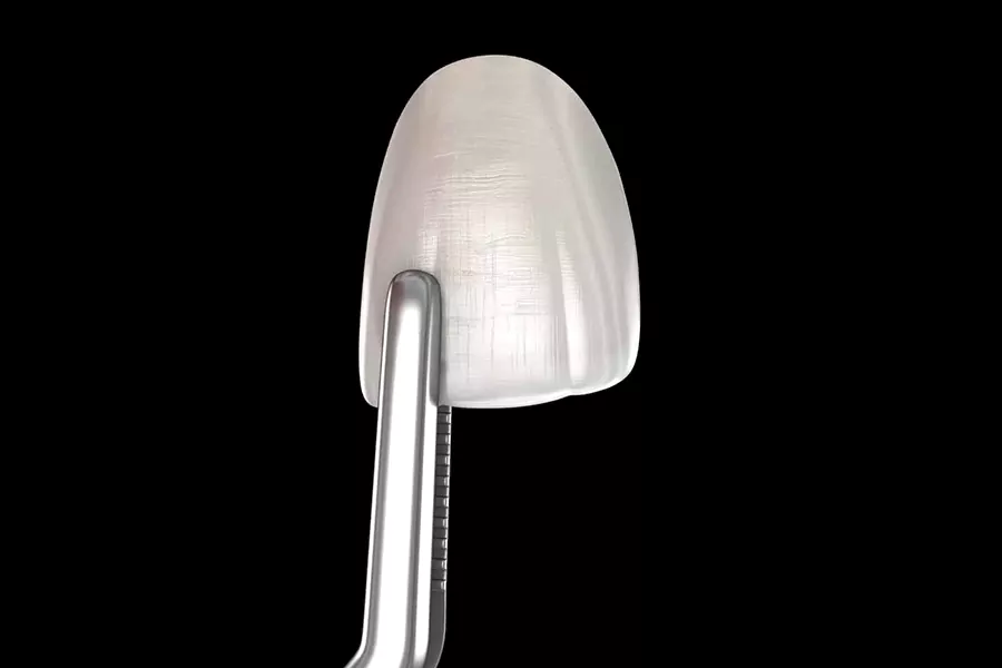 هزینه لمینت دندان