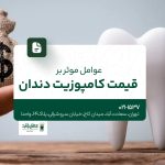 عوامل مؤثر بر قیمت کامپوزیت دندان